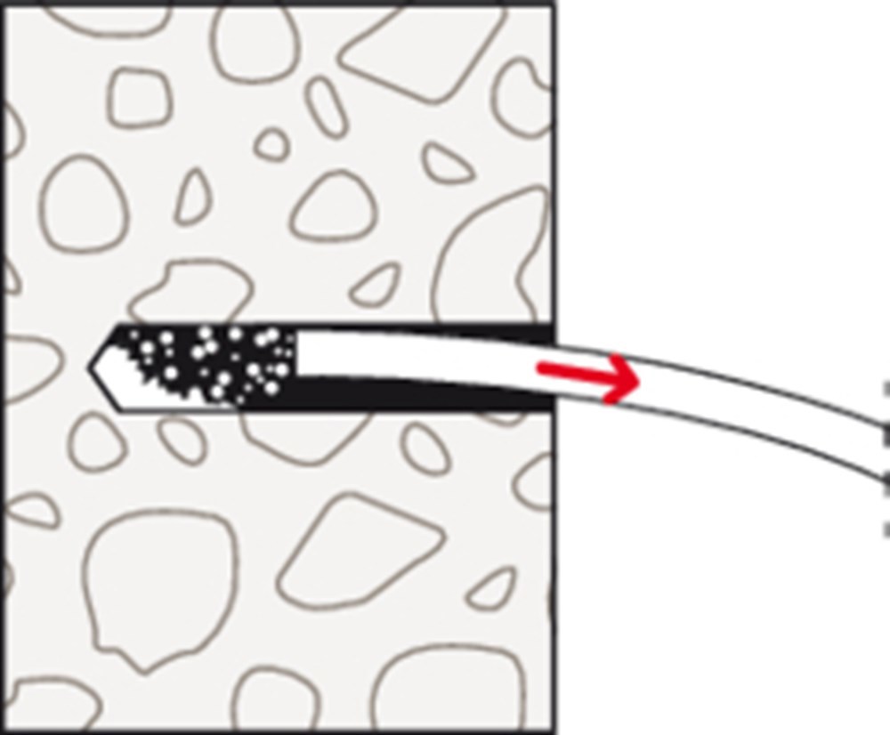hulsanker elvz fischer-6